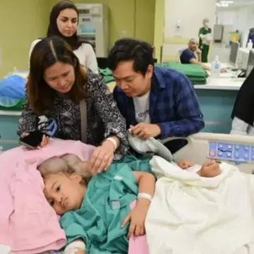 صحيفة المرصد – “الربيعة” يكشف تفاصيل عملية فصل التوأم الملتصق الفلبيني “كليا وموريس آن”.. ويُبيّن نسبة الخطر!